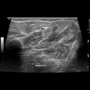 Ultrassonografia de articulações