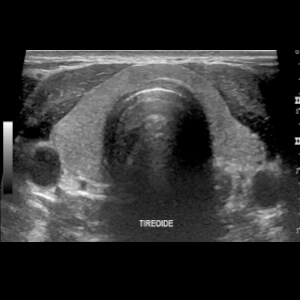 Ultrassonografia de órgãos e estruturas superficiais