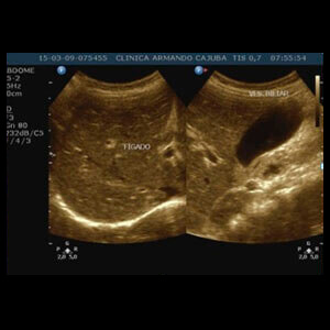 Ultrassonografia do abdome total